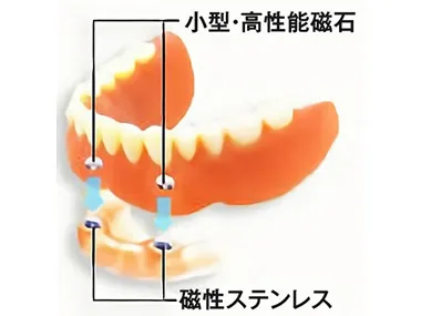 マグネットデンチャー